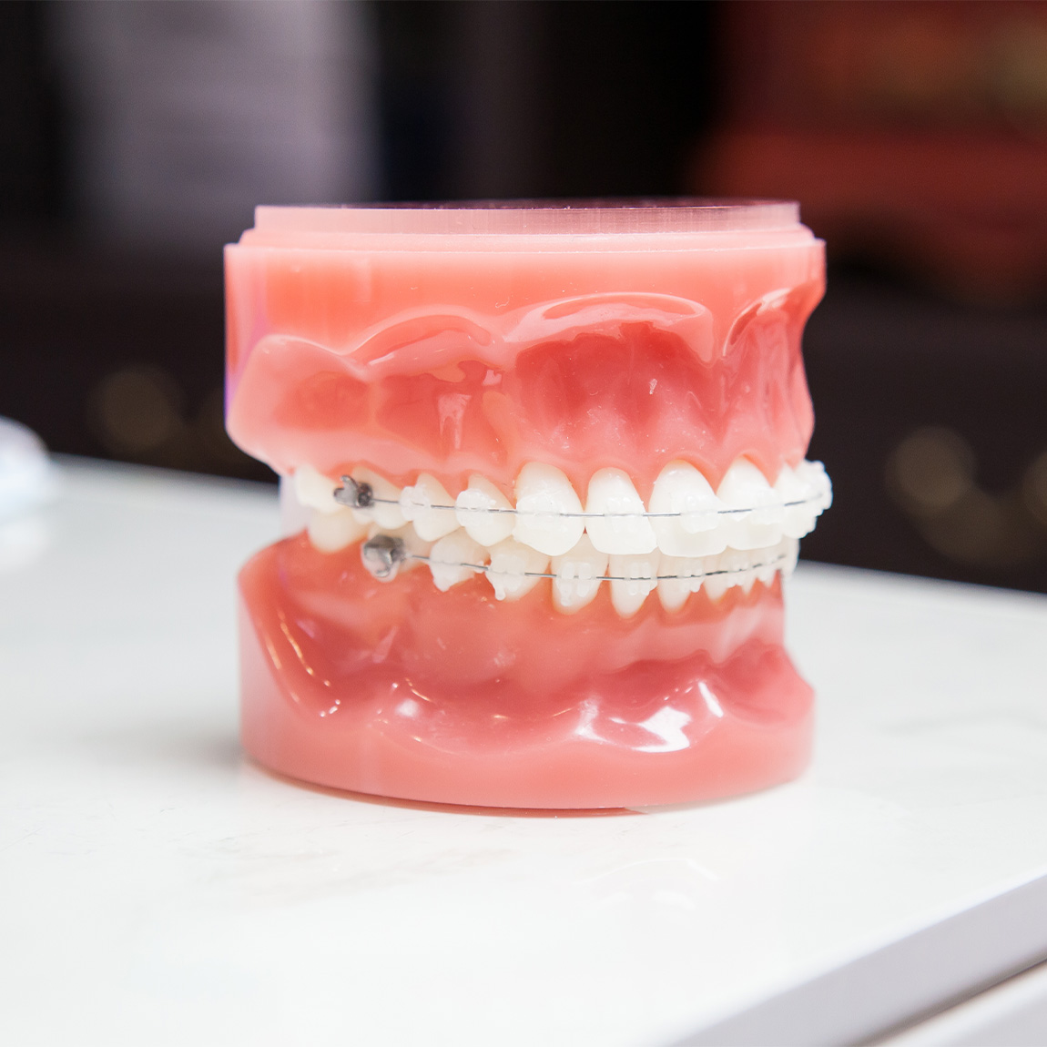 Ceramic Braces Orthodontists Near Me