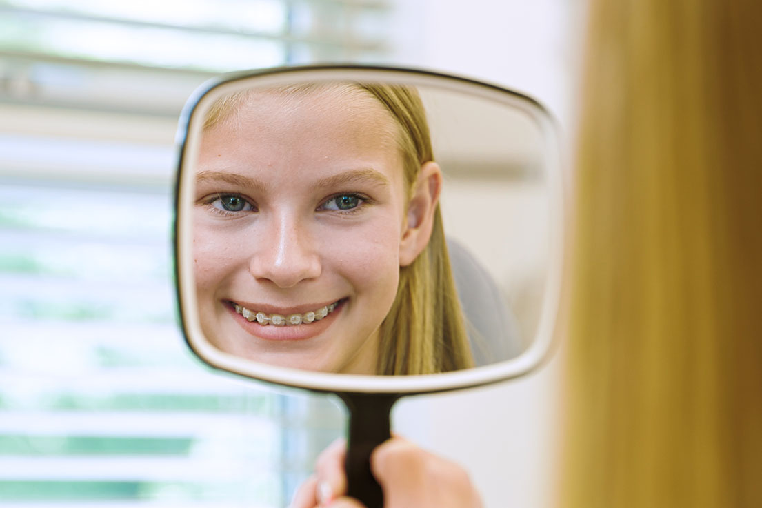 Ceramic Braces Orthodontist In West Michigan