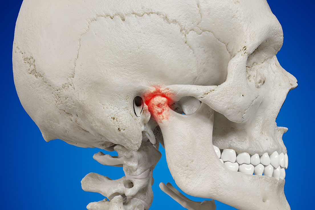 Tmj Treatment Orthodontist Near Me Tmj Treatment Orthodontist Near Me